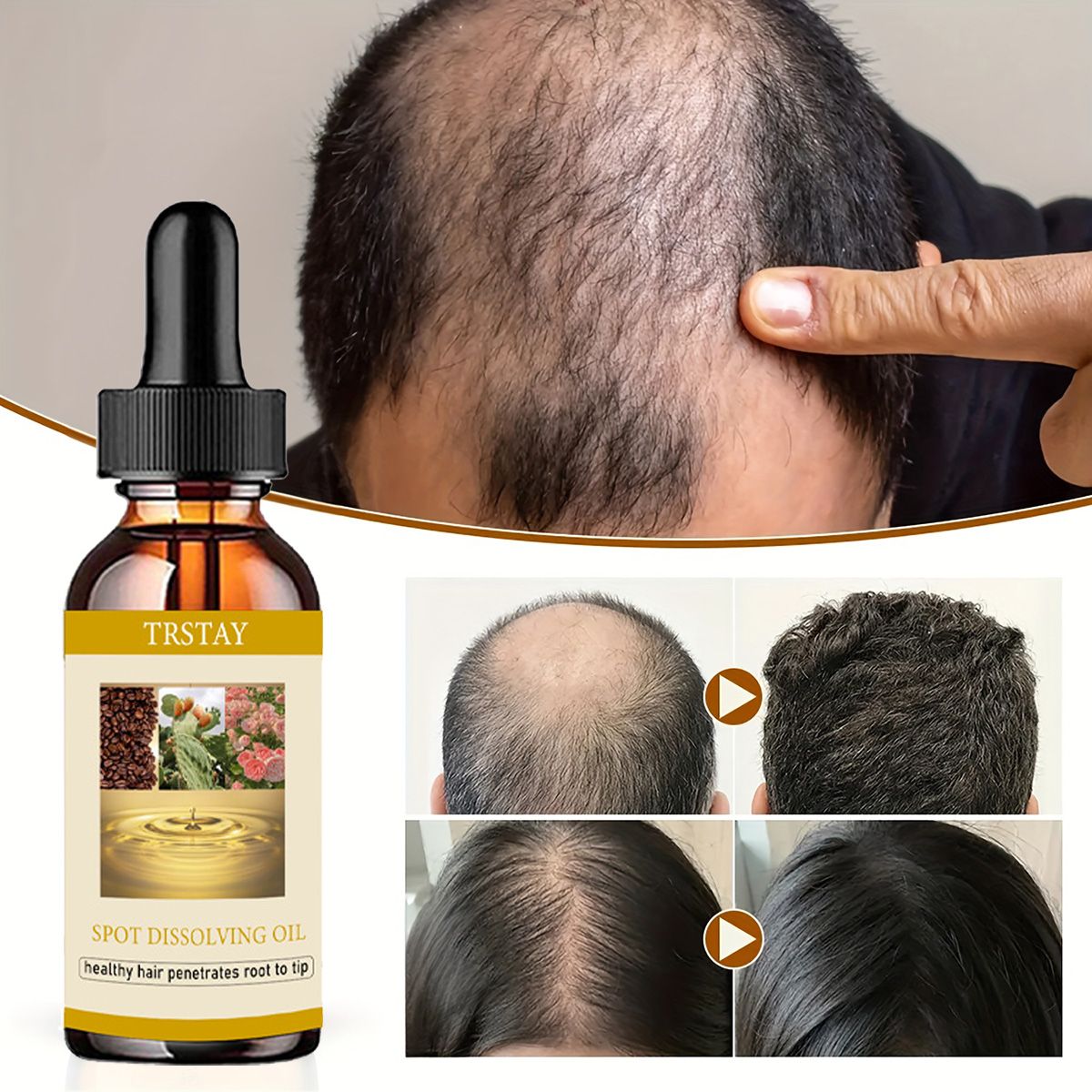Beard Oil Growth - 50ML Mọc Râu Tinh Dầu Chống