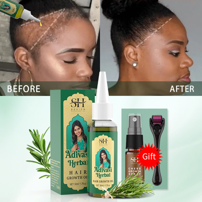 Ayurvedic Hair Growth Oil Indi - đánh giá và giá Beard Oil Growth