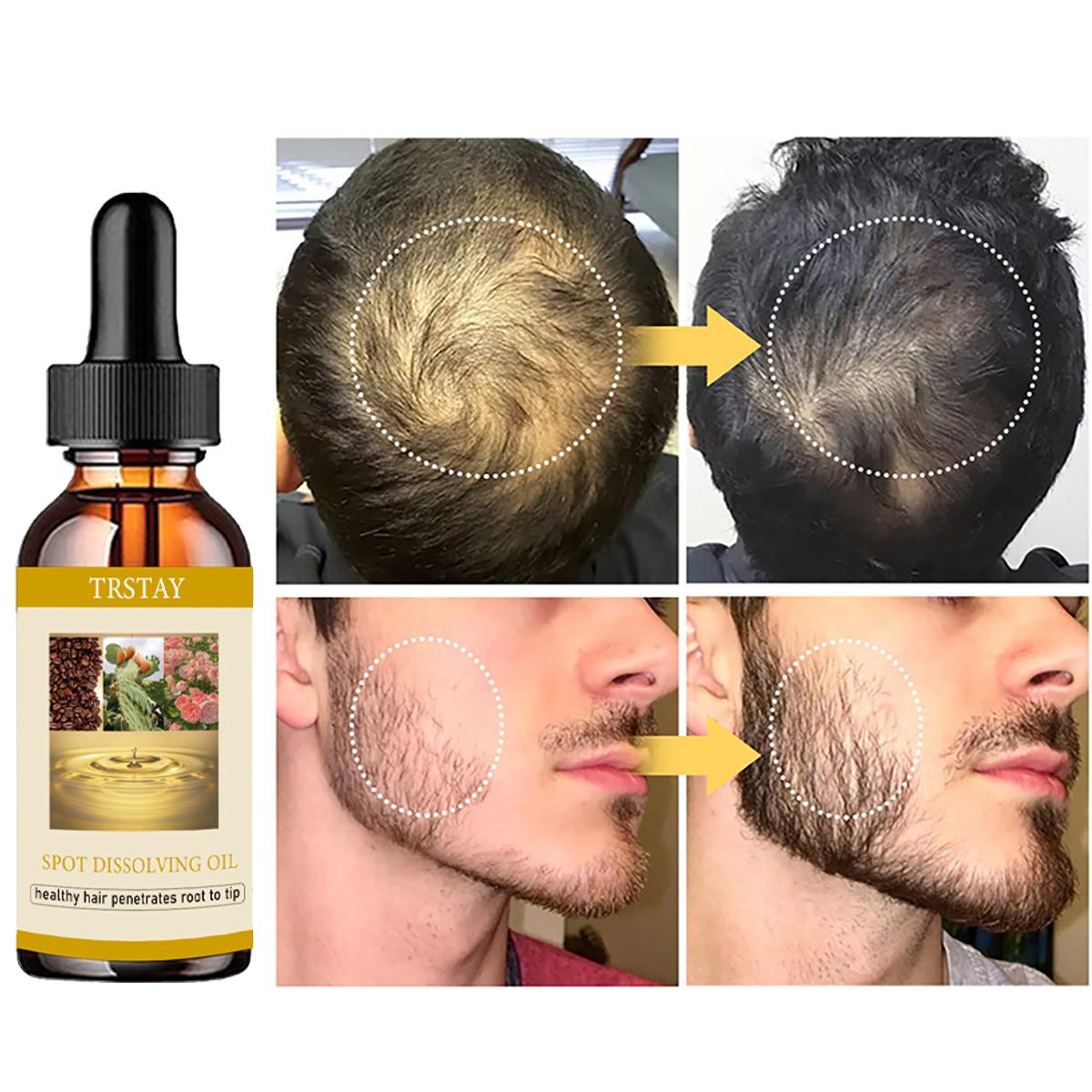 50ML Mọc Râu Tinh Dầu Chống Rụ - đánh giá và giá Beard Oil Growth