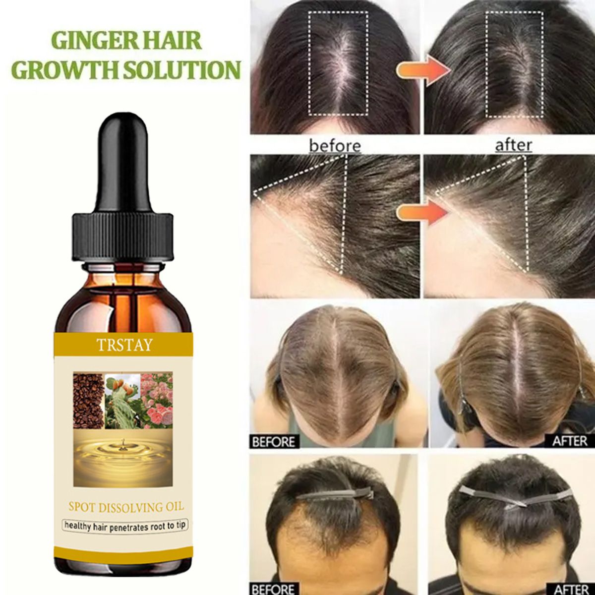 50ML Mọc Râu Tinh Dầu Chống Rụ - đánh giá và giá Beard Oil Growth